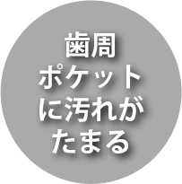 歯周ポケットに汚れがたまる